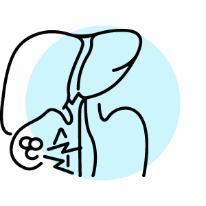 Gallbladder Stones and Tumors