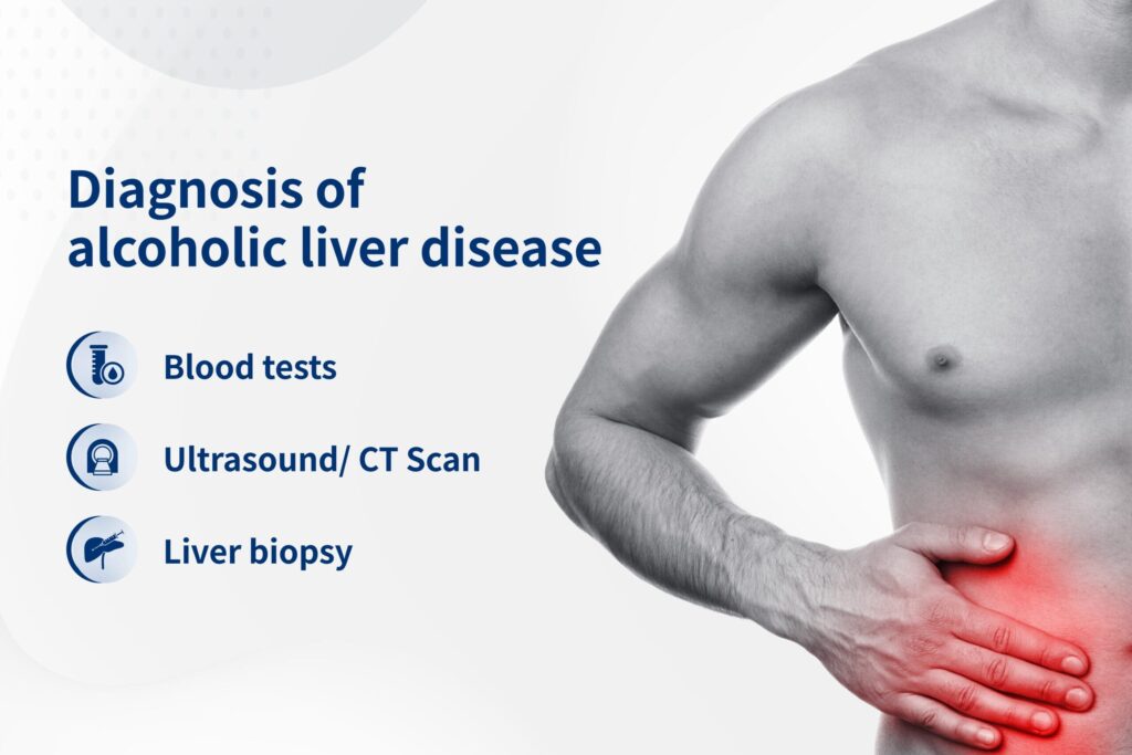 Diagnosis of alcoholic liver disease