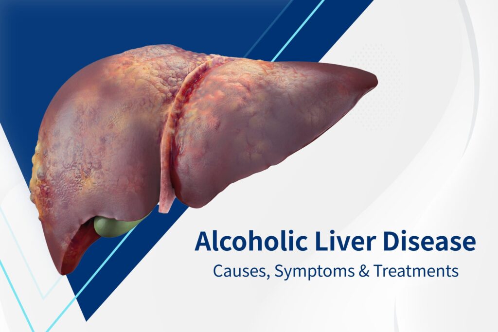 What are the Possible Treatments for Alcoholic Liver