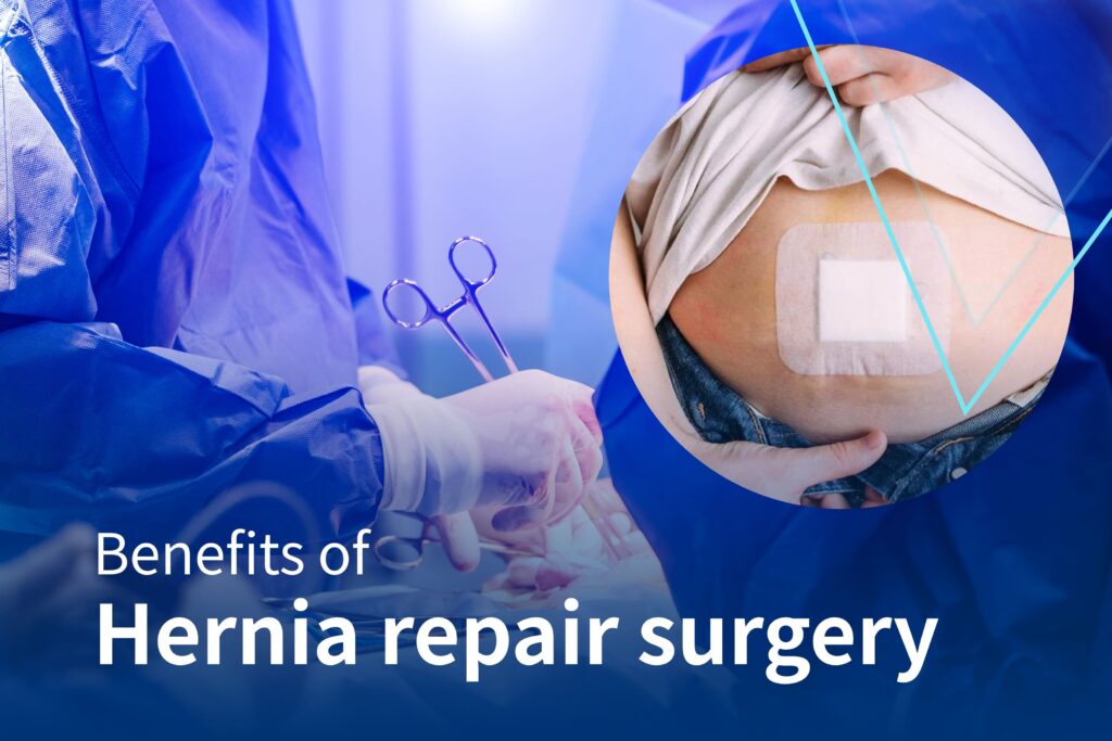 Cpt Hernia Repair 2025 Geri Pennie