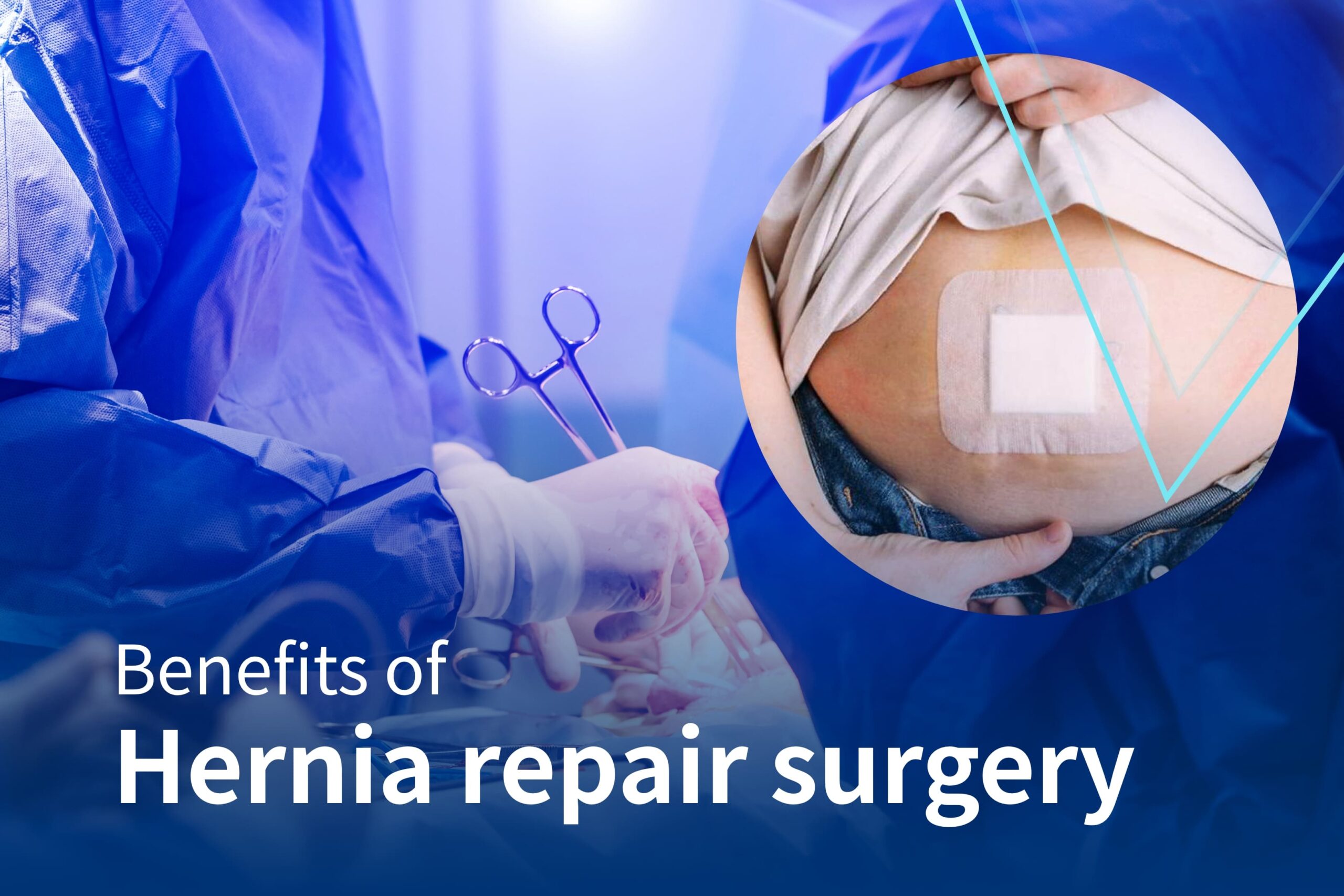 benefits of hernia surgery