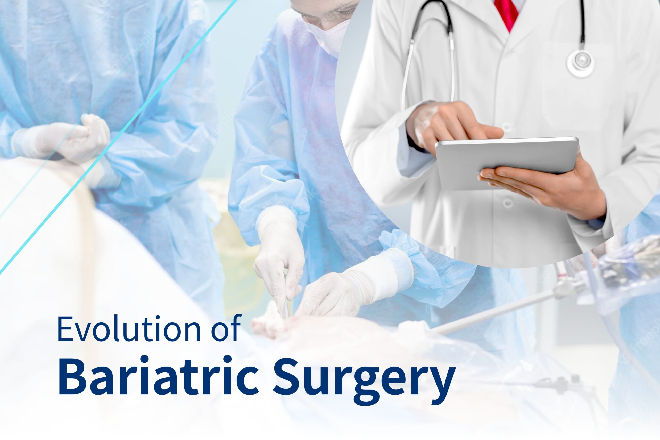 Evolution Of Bariatric Surgery