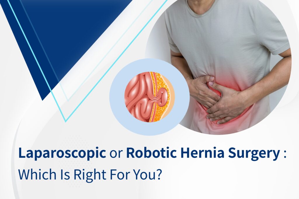 LAPROSCOPIC OR HERNIA SURGERY WHICH IS RIGHT FOR YOU