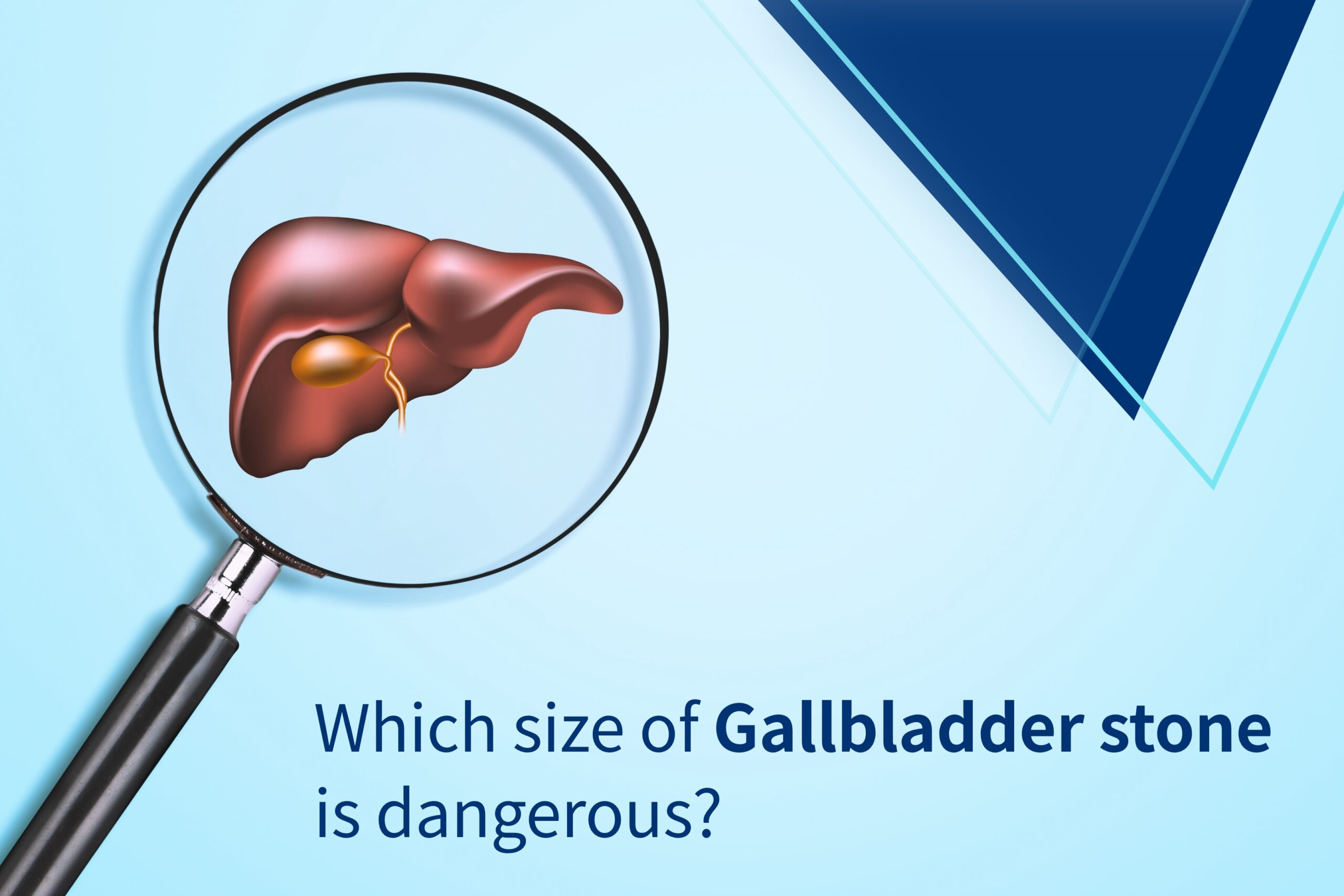which size of gallbladder stone is dangerous