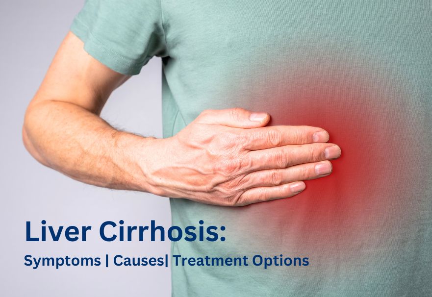 Liver Cirrhosis Symptoms, Causes, and Treatment Options (1)